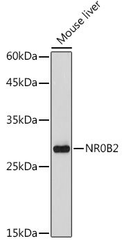 Anti-NR0B2 Antibody (CAB1836)