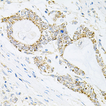 Anti-IRS1 Antibody (CAB0245)