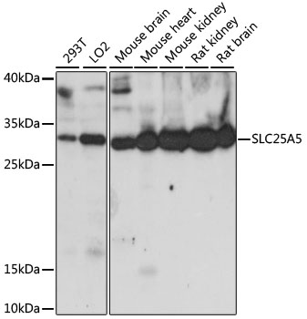 Anti-SLC25A5 Antibody (CAB15639)