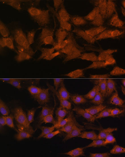 Anti-DDX3X Antibody (CAB5637)