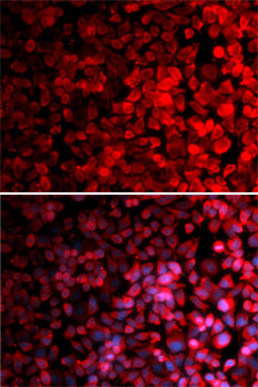 Anti-RPS10 Antibody (CAB5880)