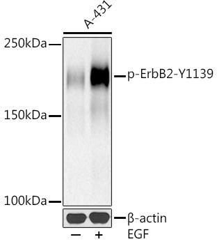 Western blot analysis of extracts of A-431 cells, using Phospho-ErbB2-Y1139 at 1:500 dilution. A-431 cells were treated by EGF (100 ng/ml) at 37Ã¢â€žÆ’ for 30 minutes after serum-starvation overnight. Secondary antibody: HRP Goat Anti-Rabbit IgG (H+L) at 1:10000 dilution. Lysates/proteins: 25ug per lane. Blocking buffer: 3% nonfat dry milk in TBST. Detection: ECL Basic Kit. Exposure time: 90s.