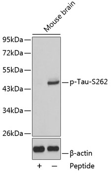 Anti-Phospho-MAPT-S262 Antibody (CABP0397)