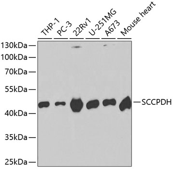 Anti-SCCPDH Antibody (CAB2148)