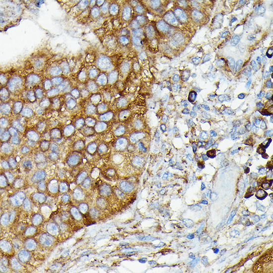 Anti-CYLD Antibody (CAB3821)