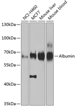 Anti-Albumin Antibody (CAB0353)