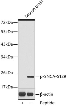 Anti-Phospho-Alpha-synuclein-S129 Antibody (CABP0450)