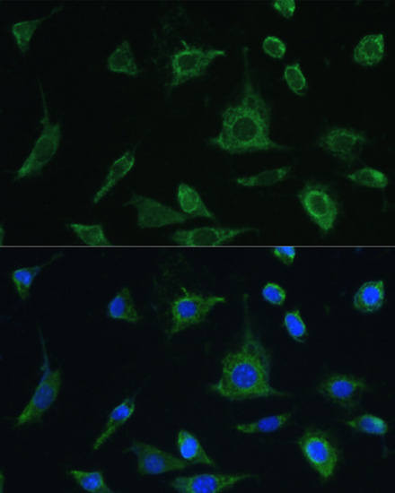 Anti-OSM Antibody (CAB6163)