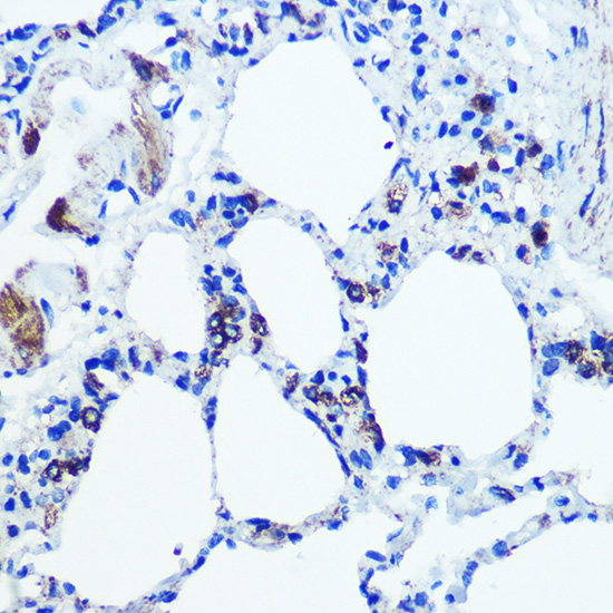 Anti-MAOB Antibody (CAB1568)