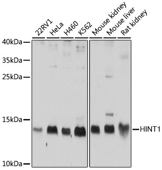 Anti-HINT1 Antibody [KO Validated] (CAB10221)