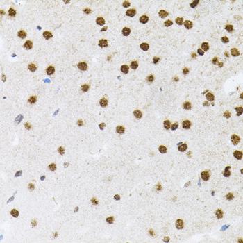 Anti-FAF1 Antibody (CAB7779)