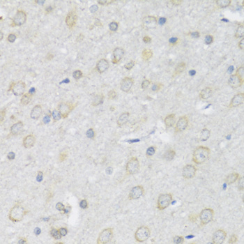 Anti-P2RX7 Antibody (CAB10511)