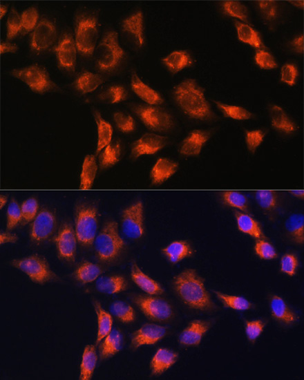 Anti-C1 Inactivator Antibody (CAB1717)