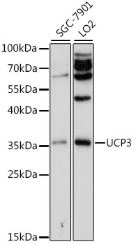 Anti-UCP3 Antibody (CAB1532)