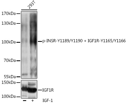 Anti-Phospho-INSR-Y1189/Y1190 + IGF1R-Y1165/Y1166 Antibody (CABP1086)