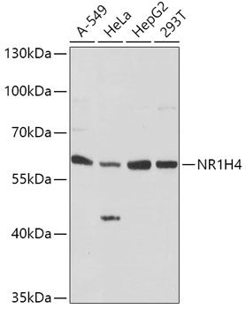 Anti-Bile acid receptor Polyclonal Antibody (CAB8320)