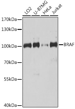 Anti-BRAF Antibody (CAB15033)