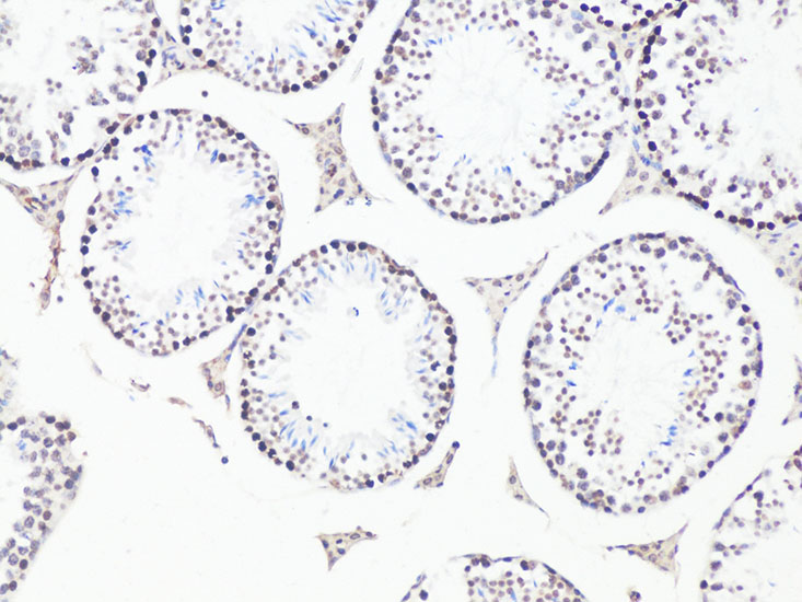 Anti-Bcl9 Antibody (CAB6795)