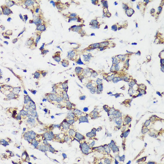 Anti-TSC1 Antibody (CAB0720)