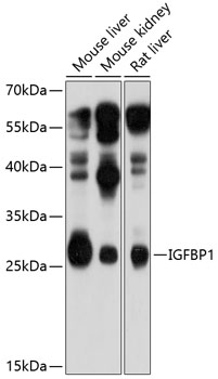 Anti-IGFBP1 Antibody (CAB11109)