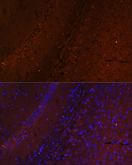 Anti-RUSC1 Antibody (CAB15417)