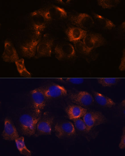 Anti-ATL2 Antibody (CAB15884)