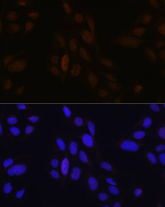 Anti-Pea3 / ETV4 Antibody (CAB5797)