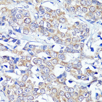 Anti-CNR2 Antibody (CAB1762)