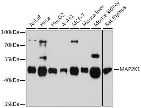 Anti-MAP2K1 Antibody [KO Validated] (CAB12687)