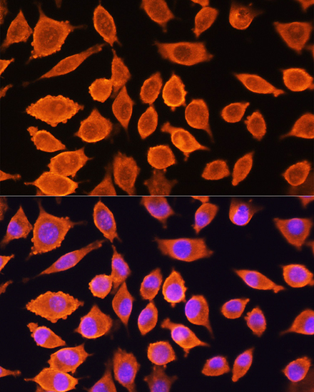 Anti-SIAH1 Antibody (CAB2494)