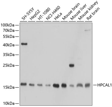 Anti-HPCAL1 Antibody (CAB10019)