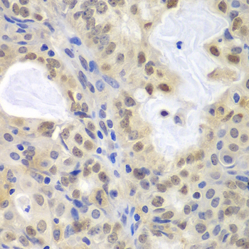 Anti-MCM3 Antibody (CAB1060)