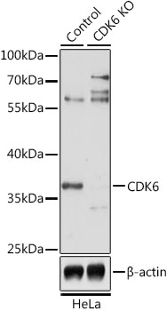 Anti-CDK6 Antibody [KO Validated] (CAB1545)