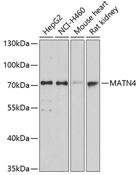 Anti-MATN4 Antibody (CAB2761)