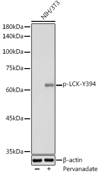 Anti-Phospho-LCK-Y394 Antibody (CABP0182)