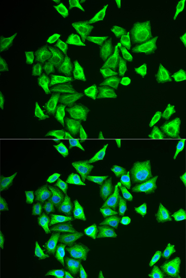 Anti-PGM1 Antibody (CAB6303)