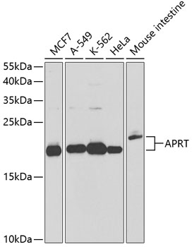 Anti-APRT Antibody (CAB13946)