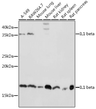 Anti-IL-1 beta Antibody (CAB16288)