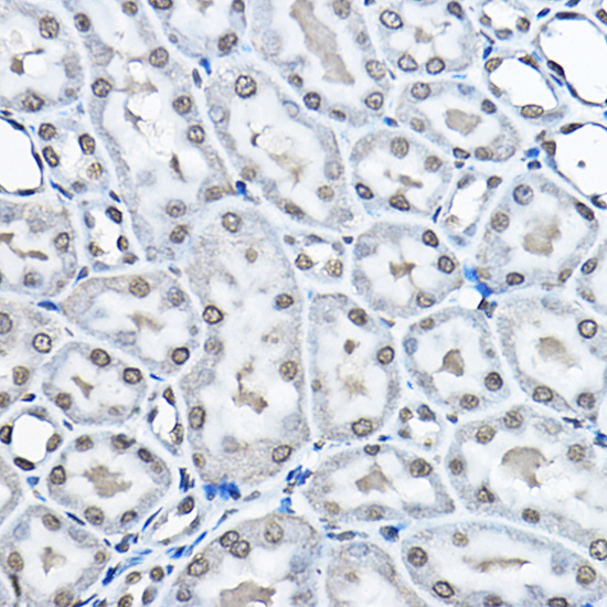 Anti-MonoMethyl-Histone H3-K27 Antibody (CAB2361)