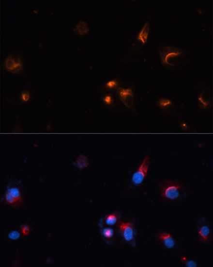 Anti-GRIN1 Antibody (CAB7167)