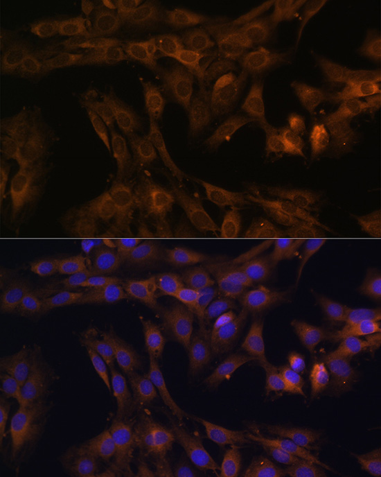 Anti-FoxO3a Antibody (CAB0102)