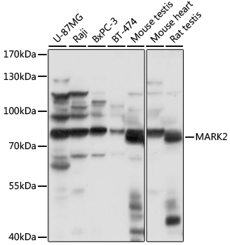 Anti-MARK2 Antibody (CAB16706)