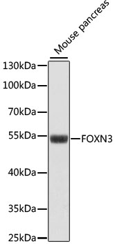 Anti-FOXN3 Antibody (CAB15039)