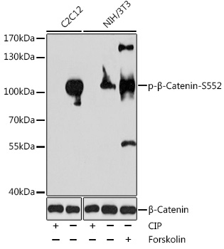 Anti-Phospho-CTNNB1-S552 Antibody (CABP0579)