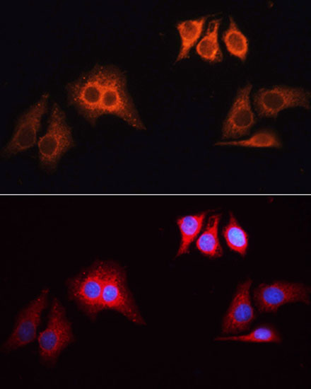 Anti-Rhodamine (TRITC) Goat Anti-Rabbit IgG (H+L) Antibody (CABS040)