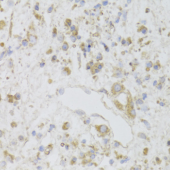 Anti-CIAPIN1 Antibody (CAB6336)