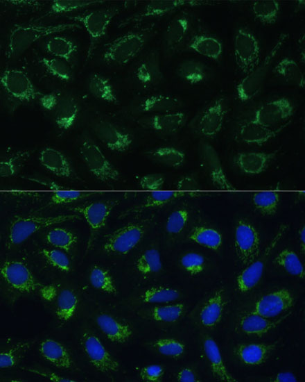 Anti-ETFB Antibody (CAB16043)