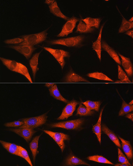 Anti-ALDOB Antibody (CAB3728)