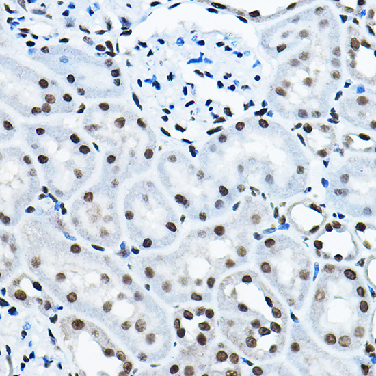 Anti-KAT7 Antibody (CAB5823)