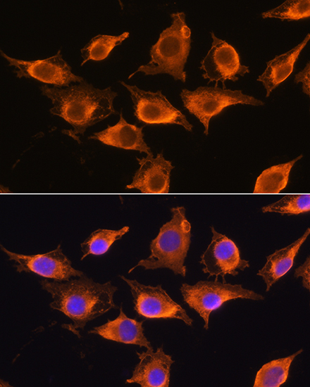 Anti-ZCCHC11 Antibody (CAB5972)